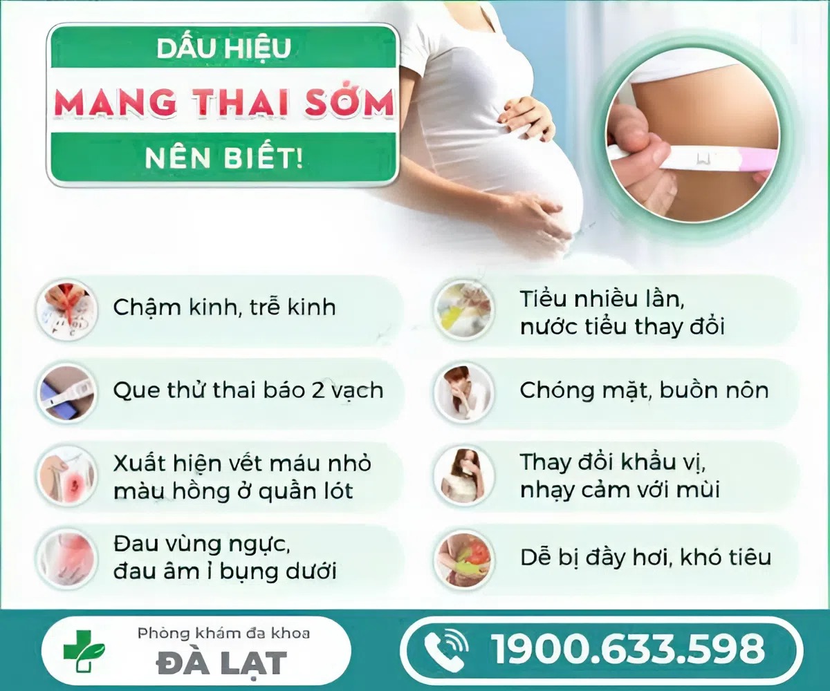 Hình ảnh minh họa